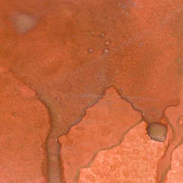 Close-up of a rusty metal surface with oxidation and corrosion.